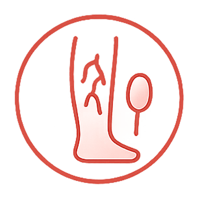 درمان واریس پا