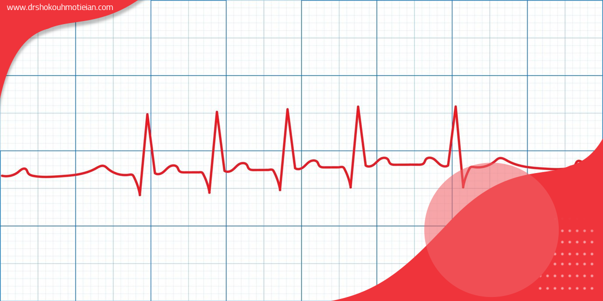 نحوه انجام نوار قلب