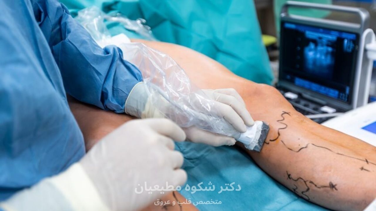 قبل از لیزر چه بررسیهایی لازم است؟