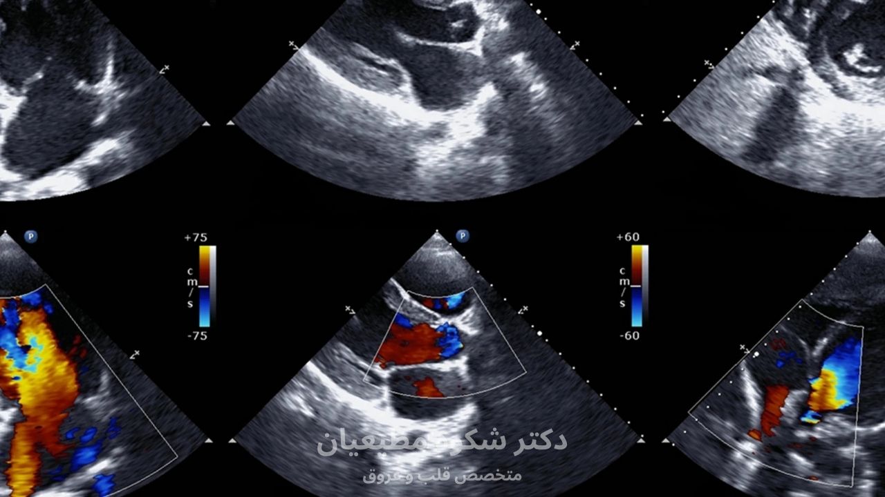 اکو قلب چه مواردی را بررسی میکند؟