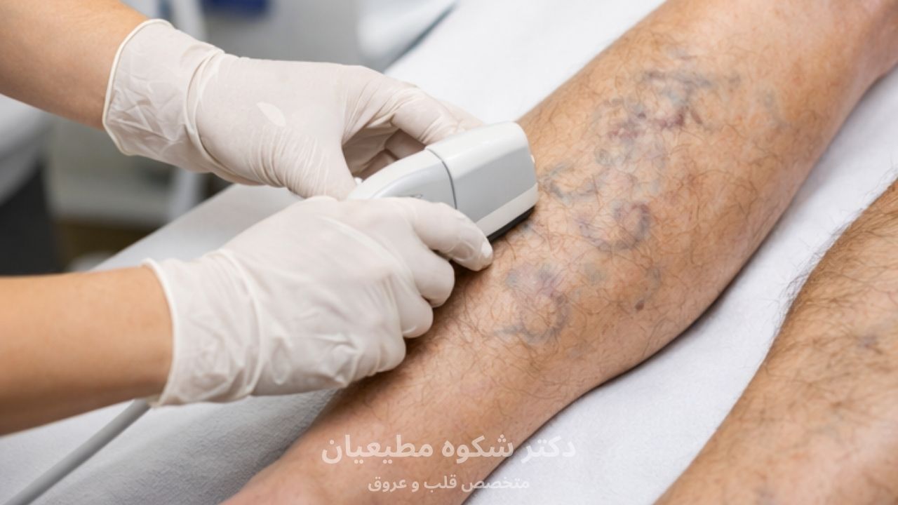 متخصص بیماریهای عروق محیطی و وریدی (Vascular Medicine / Venous Disorders)